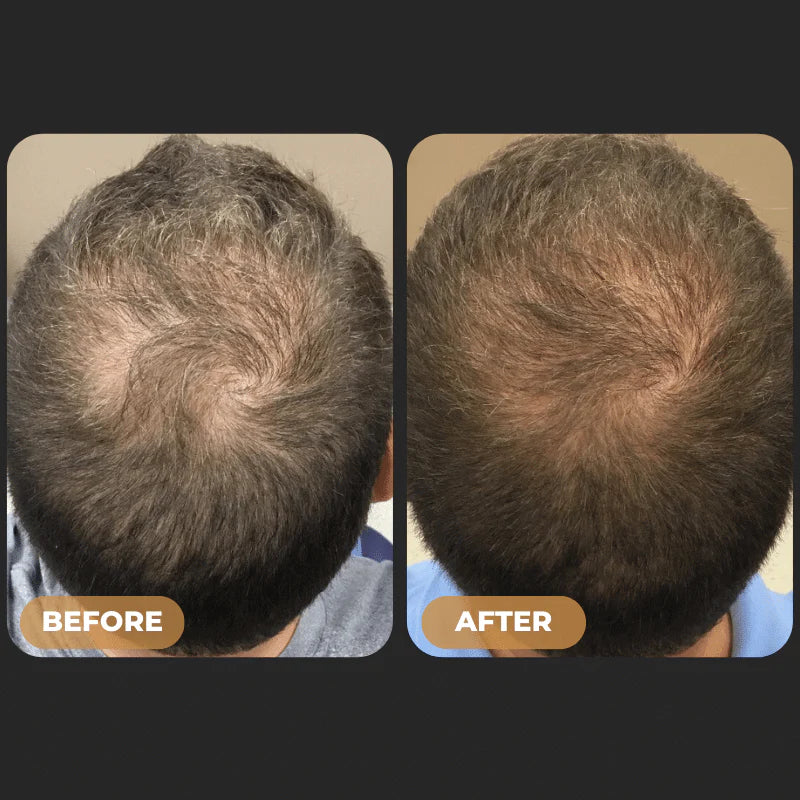 Byron Labs™ Root Activator Hair Care Full Hair Growth System
