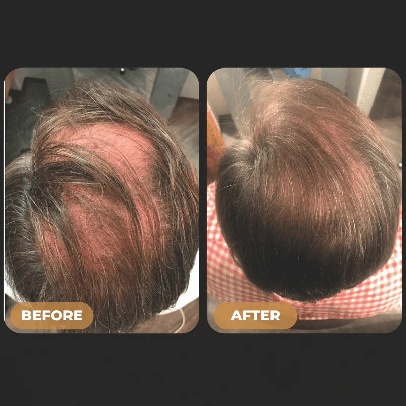 Byron Labs™ Root Activator Hair Care Full Hair Growth System