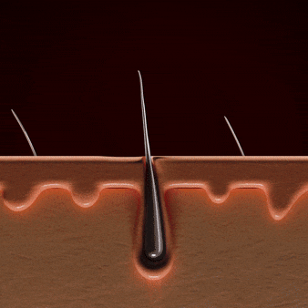 ByronBiolabs® Laser Cap – A Breakthrough in Hair Regrowth
